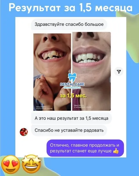 Емделу нәтижесі: Дилфуза Каримова