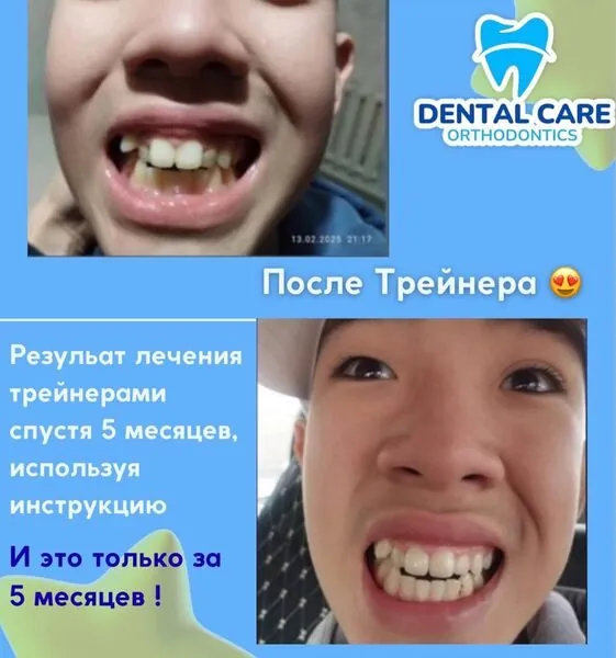Емделу нәтижесі: Жанар Муратова