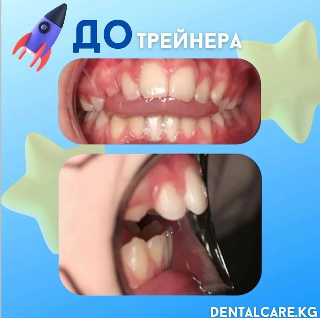 Трейнерге дейін