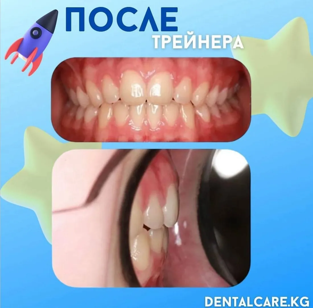 Трейнерден кейін