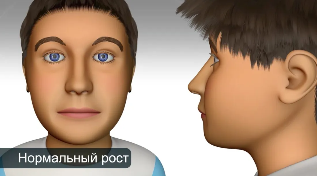 Беттің қалыпты өсуі